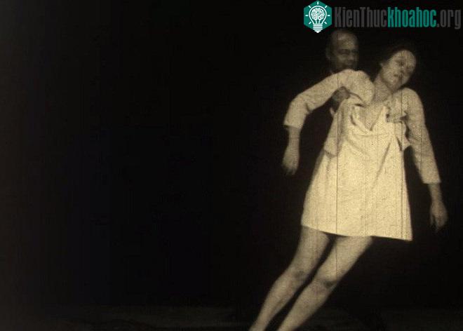 Từ năm 1915 đến 1926, có khoảng 5 triệu người trên thế giới mắc căn bệnh kỳ lạ này.