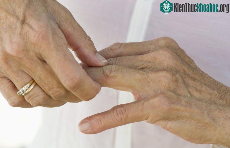 Những cơn đau khớp không liên quan đến trời mưa.