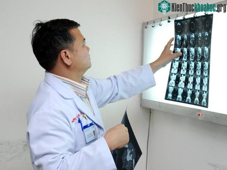 Trước khi tiến hành tán sỏi thận, bác sĩ sẽ kiểm tra phim đánh giá mức độ sỏi.