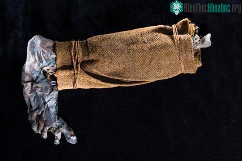 Một cái chân được tìm thấy trong đầm lầy vào năm 1944. Các bộ phận của cơ thể vô tình được bảo quản trong đầm lầy thường được tìm thấy bởi nông dân.