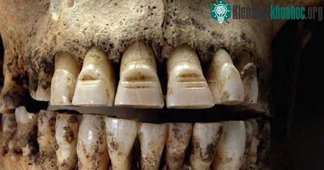 Chiến binh mài rãnh trên răng mới là chiến binh tinh nhuệ
