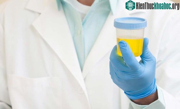 Lưu trữ mẫu trong cấu trúc kim loại-hữu cơ hybrid nhỏ có thể là một sự thay thế cho kho lạnh.