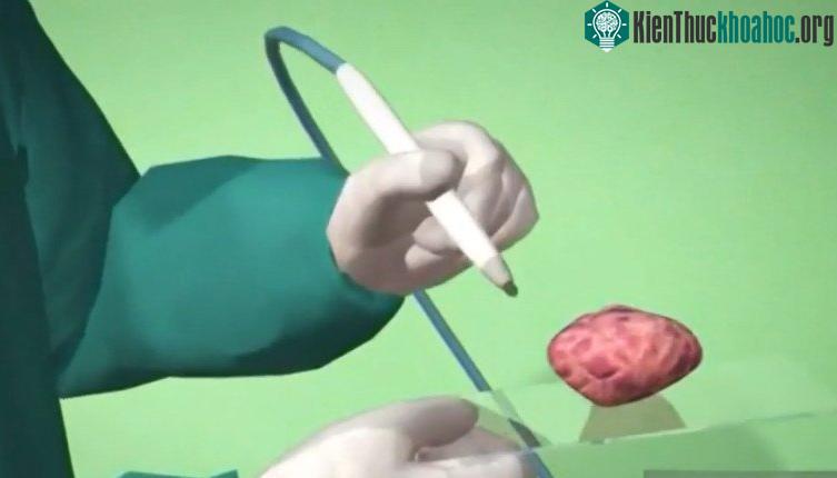 Chiếc bút được thiết kế để các chuyên gia y khoa sử dụng trong lúc phẫu thuật.