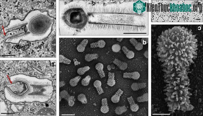 Hình ảnh phóng đại ở các kích thước khác nhau của Tupanvirus.