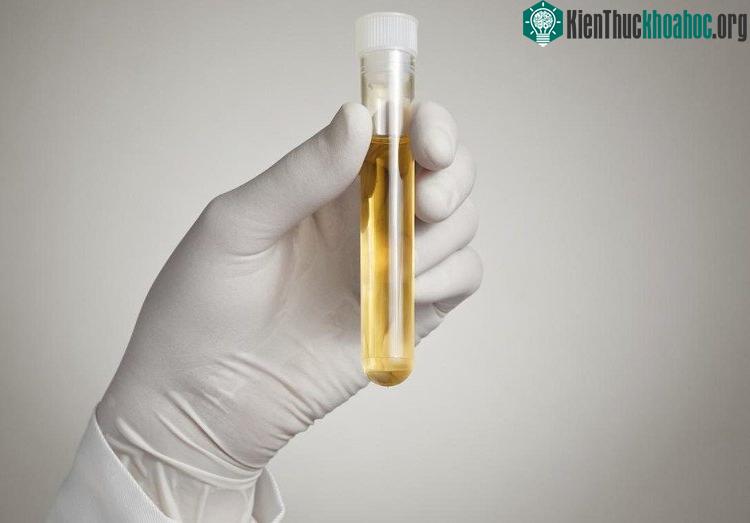 Chất đánh dấu sinh học hứa hẹn như một chỉ số đáng tin cậy để xác định tuổi sinh học.