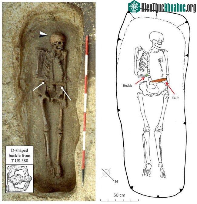 Hài cốt người đàn ông mang bộ phận giả ở Italy. (Ảnh: Science Alert).