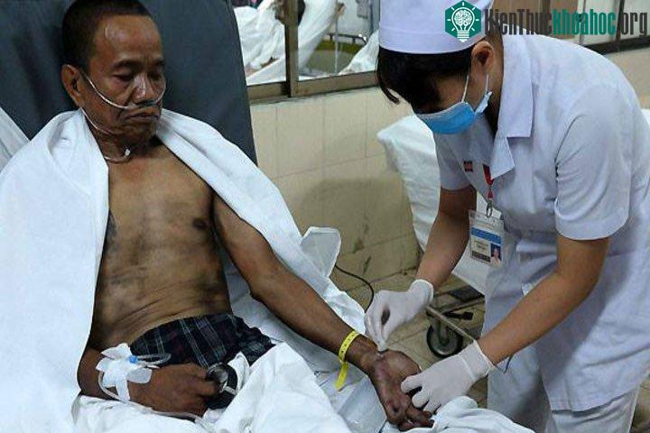Cấp cứu nạn nhân vụ cháy chung cư bị bỏng hô hấp. (Ảnh: Lê Phương).