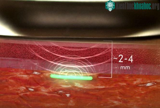 Cảm biến được làm bằng vật liệu tổng hợp hydrogel mềm mỏng tương tự như kính áp tròng.