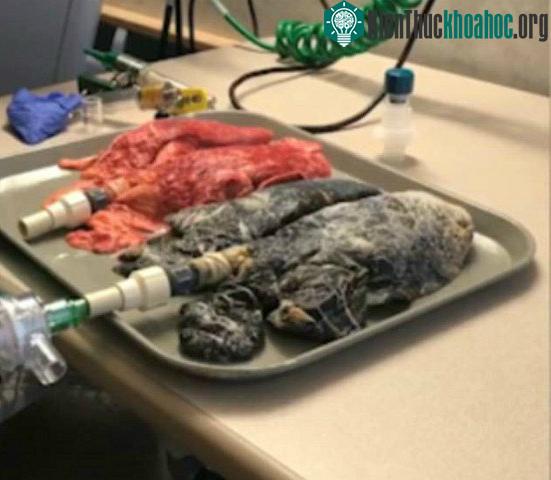 Thí nghiệm cho thấy sự khác biệt giữa phổi của người khỏe mạnh và người hút thuốc. (Ảnh: A.E).