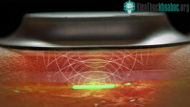 Cảm biến sinh học gắn trên da để theo dõi sức khỏe.
