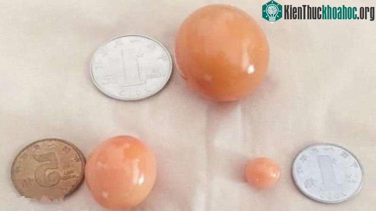 Ba viên mỹ nhạc châu của ông Trần.