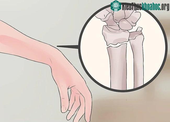 Quan sát hiện tượng lệch hoặc vẹo