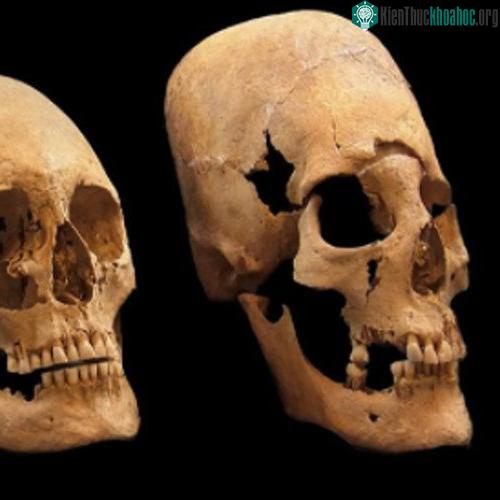 Việc hộp sọ dài giống người ngoài hành tinh là do có sự tác động của con người