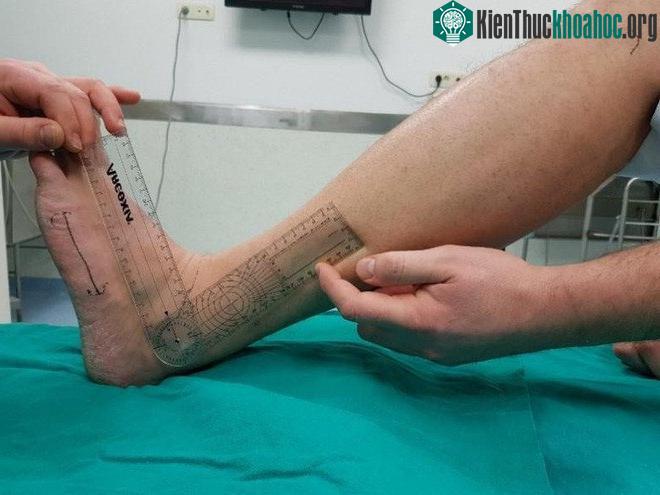 Khớp mắt cá chính là yếu tố mang tính quyết định đến khả năng ngồi