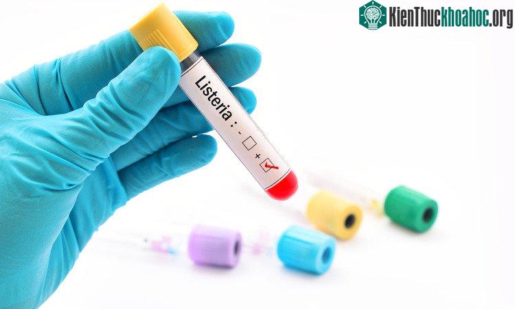 Xét nghiệm máu mới giúp phát hiện ung thư tuyến tiền liệt chính xác, ít tốn kém và ít đau đớn hơn sinh thiết - (ảnh: HUFFINGTON POST).