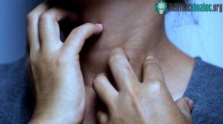 Cảm giác như cả người lúc nhúc côn trùng: căn bệnh lạ khiến nhiều người khổ sở ảnh 0