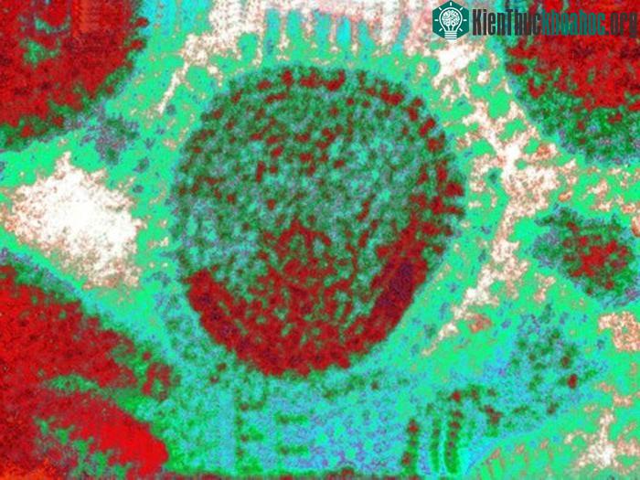 Việc protein bề mặt của virus cúm thay đổi cấu trúc liên tục khiến các kháng thể của các tế bào chủ bị nhiễu loạn thông tin không nhận dạng được virus - (Ảnh: Global Look Press).