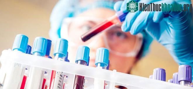 Hai hiện tượng trên là tình trạng xét nghiệm không chính xác với bệnh.