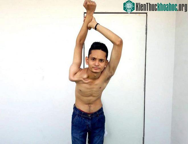 Yash có thể xoay cánh tay 360 độ vô cùng dễ dàng như thể người anh không được cấu tạo từ một bộ khung xương.
