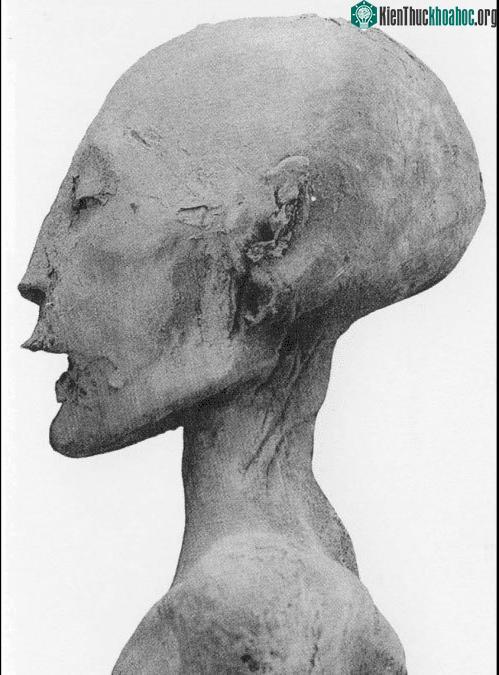 Cha mẹ của Pharaoh Tutankhamun gần đây được xác minh là anh em ruột.
