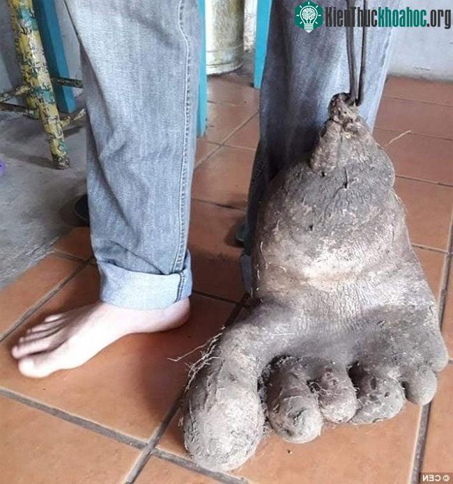 Củ khoai tây mang hình dạng sáu ngón chân. (Ảnh: CEN).