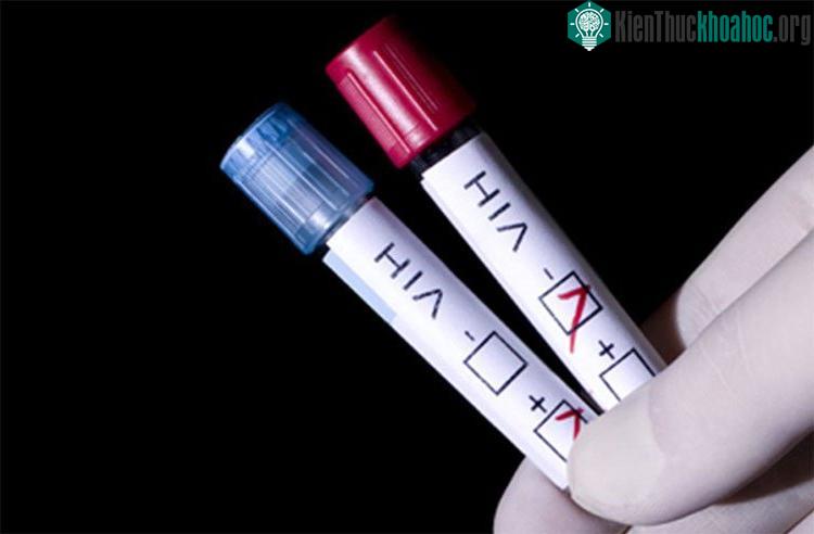 Xét nghiệm HIV sẽ giúp bạn phòng tránh, giảm nguy cơ lây nhiễm HIV sang cho người khác.