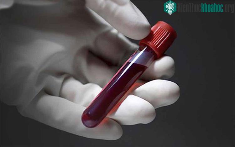 Rồi đây bạn có thể biết trước khi nào mình chết chỉ thông qua một xét nghiệm máu
