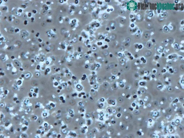 Vi khuẩn Planococcus halocryophilus