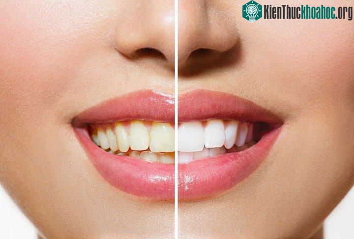 Màu vàng của răng cũng có thể do một loạt các yếu tố liên quan đến sức khỏe.
