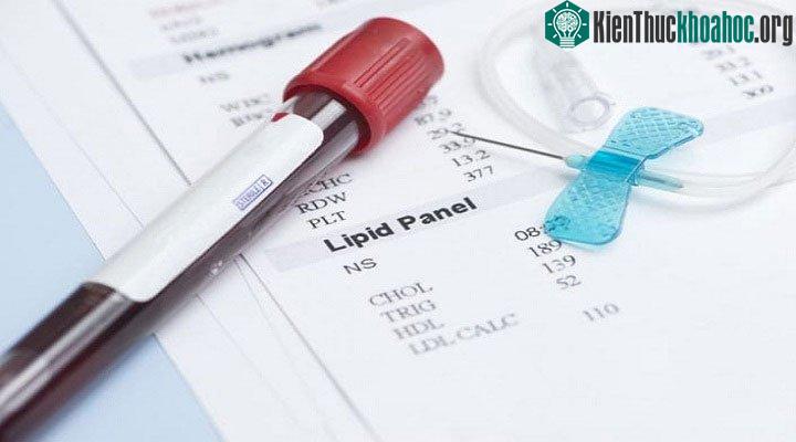 Cholesterol HDL cao hơn có thể không phải lúc nào cũng tốt đối với phụ nữ mãn kinh.