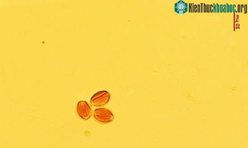 Hạt phấn hoa kẹt trong hổ phách cùng bọ cánh cứng.