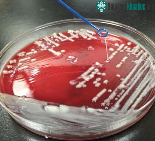 Tìm ra cách để phân biệt K. Pneumoniae và hvKp là điều cực kỳ quan trọng