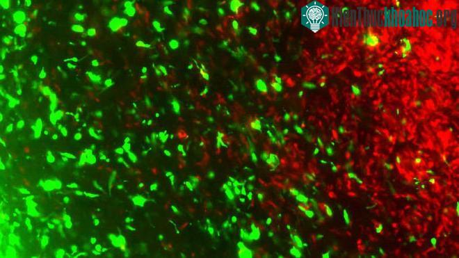 Tế bào ung thư điều chỉnh gene (xanh) tấn công các tế bào ung thư (đỏ).