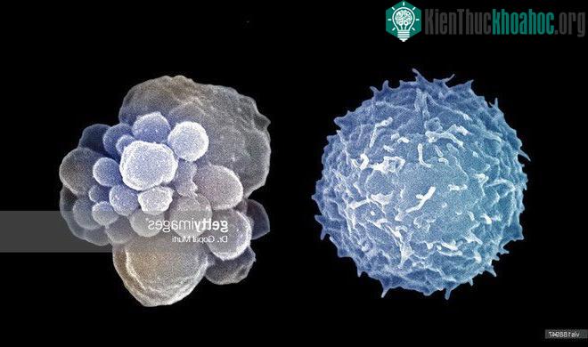 Tế bào bạch cầu khi khỏe mạnh (bên trái) và khi nó đi vào quá trình tự sát apoptosis.