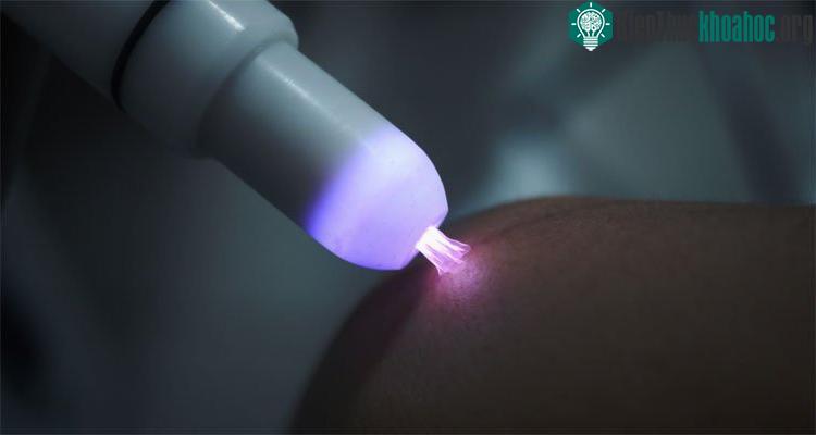 Tác động của plasma trong tiến trình liền vết thương.