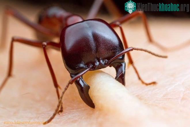 Kiến Siafu thường được những người đi thám hiểm rừng rậm sử dụng để khâu vết thương. (Ảnh: Imgur).