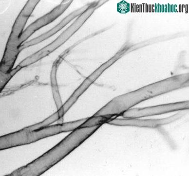 Hệ thống dẫn khí (spiracles) có lỗ mở trực tiếp trên cơ thể, giúp côn trùng có thể hô hấp được.
