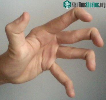 Những người này có xương khớp cực kỳ linh hoạt.