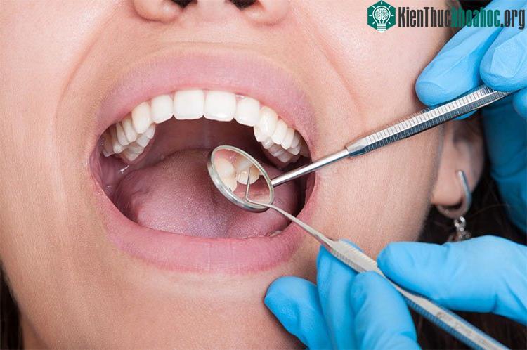 Thăm khám nha khoa gần như là một yêu cầu bắt buộc trong ung thư đầu và cổ. (Ảnh: FCD).
