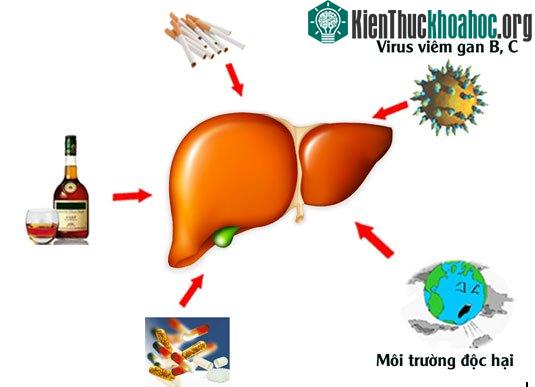 Các nguyên nhân gây bệnh xơ gan.