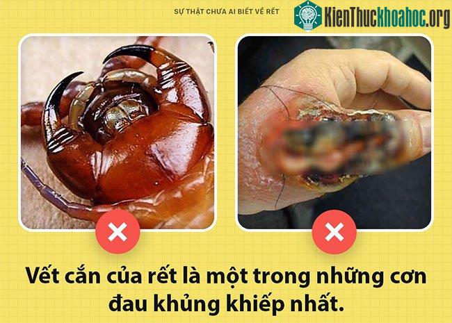 Nọc độc của rết có thể gây ra một trong những cơn đau kinh khủng nhất thế giới.