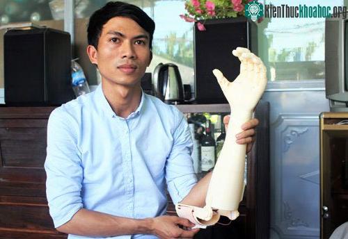 Ngô Văn Dết và sản phẩm bàn tay robot cho người khuyết tật. (Ảnh: Thạch Thảo).