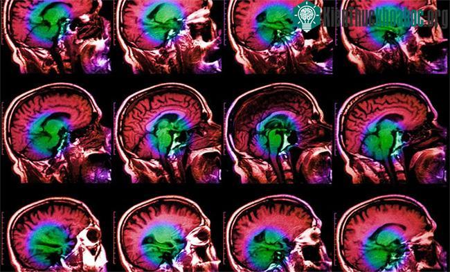 Amygdala là nơi điều khiển cảm giác buồn trong não.
