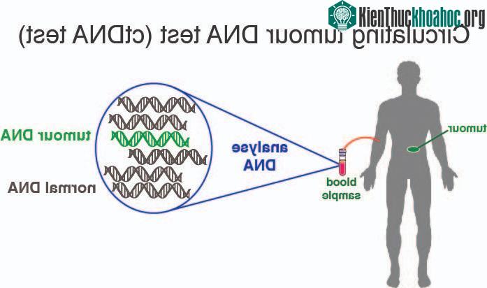 Xét nghiệm máu ctDNA rất đáng tin cậy để xác định khả năng tái phát ung thư sau phẫu thuật.