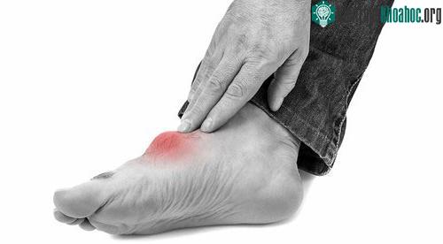 Bác sĩ có thể yêu cầu lấy mẫu nước tiểu 24 giờ nếu thấy nồng độ axit uric tăng cao trong máu của bạn.