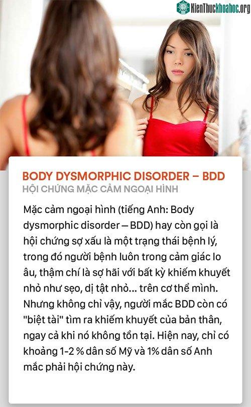 Hội chứng mặc cảm ngoại hình