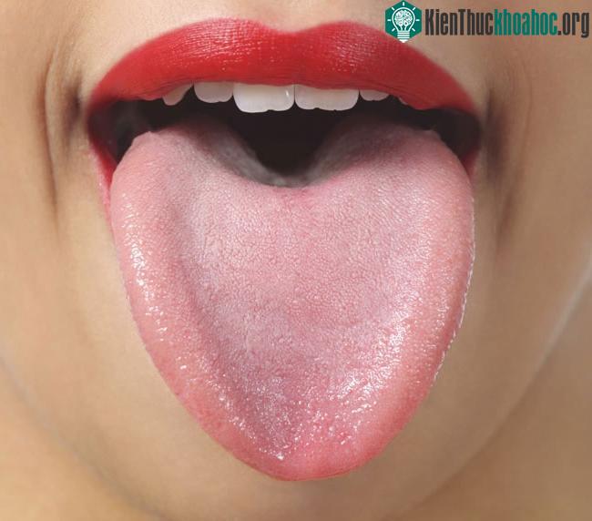 Đầu lưỡi bị đỏ còn biểu thị sự căng thẳng về tinh thần hoặc cảm xúc. (Ảnh minh họa).