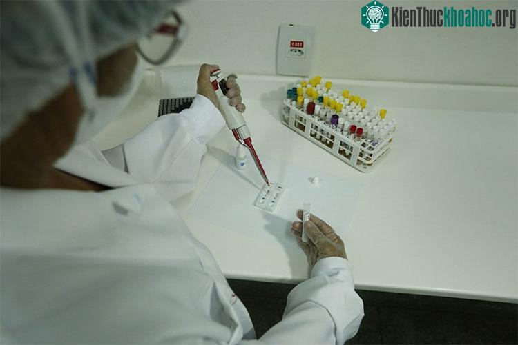 Khi hoạt động của SLO-1 bị chặn ở giữa giai đoạn trưởng thành, chức năng và tuổi thọ được cải thiện.