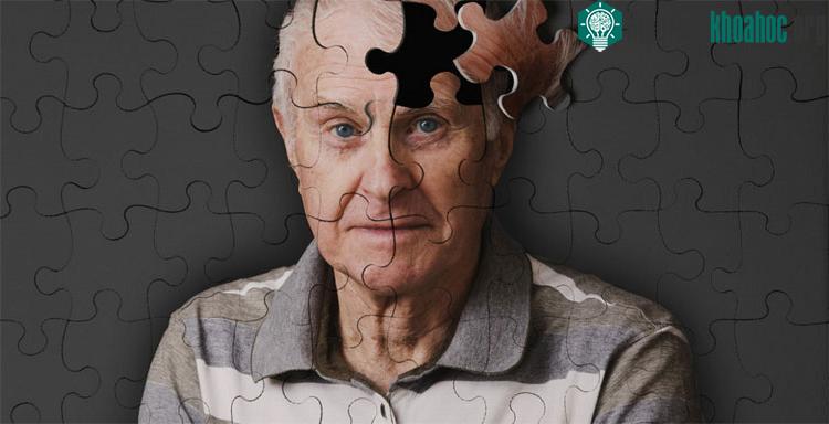 Món cocktail của Đại học Yale sẽ là thuốc đầu tiên điều trị Alzheimer? - (ảnh minh họa từ Internet).