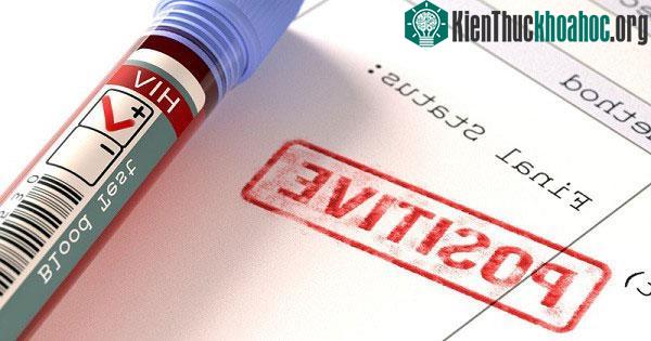 Luôn có một phần nhỏ tế bào T chứa thông tin di truyền của HIV, nhưng không phát tác ngay.